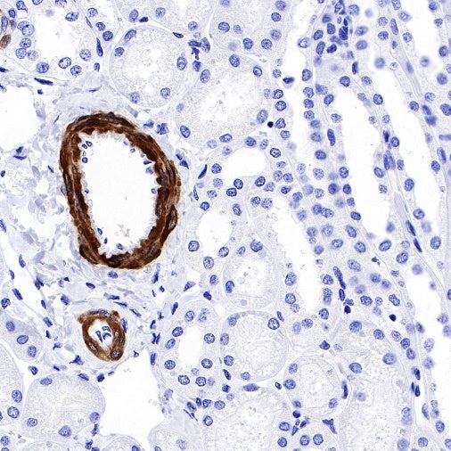 Calponin-1 Recombinant Rabbit mAb (S-R161)