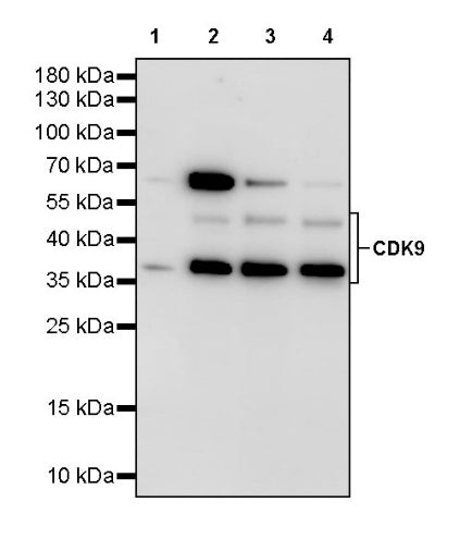 CDK9 Recombinant Rabbit mAb (S-2661-10)