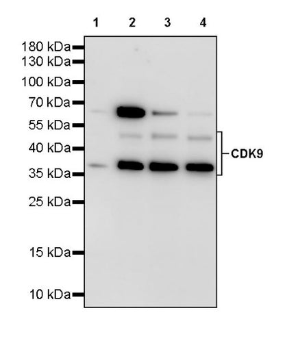 CDK9 Recombinant Rabbit mAb (S-2661-10)