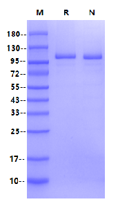 STAT6 His&Strep Tag Protein, Human