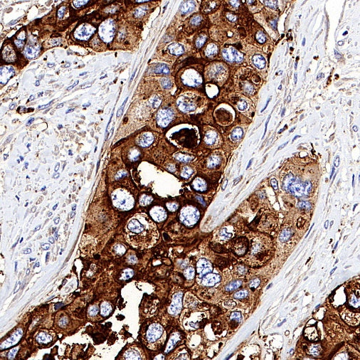 CEACAM6 Recombinant Rabbit mAb (S-720-54)