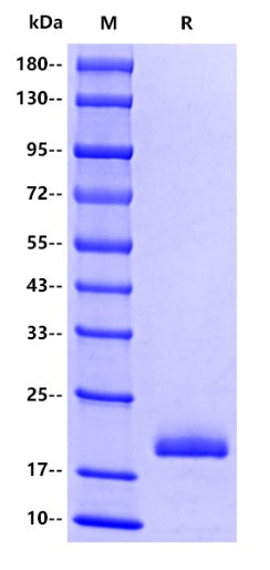Human MDM2 Protein, His tag