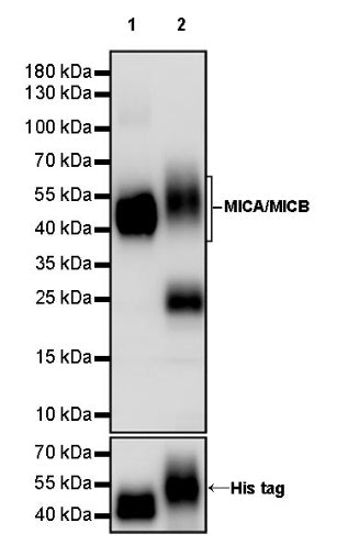 MICA/MICB Recombinant Rabbit mAb (S-1589-10)