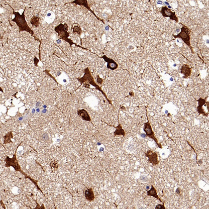 PI3 Kinase p85 beta Recombinant Rabbit mAb (S-1058-266)