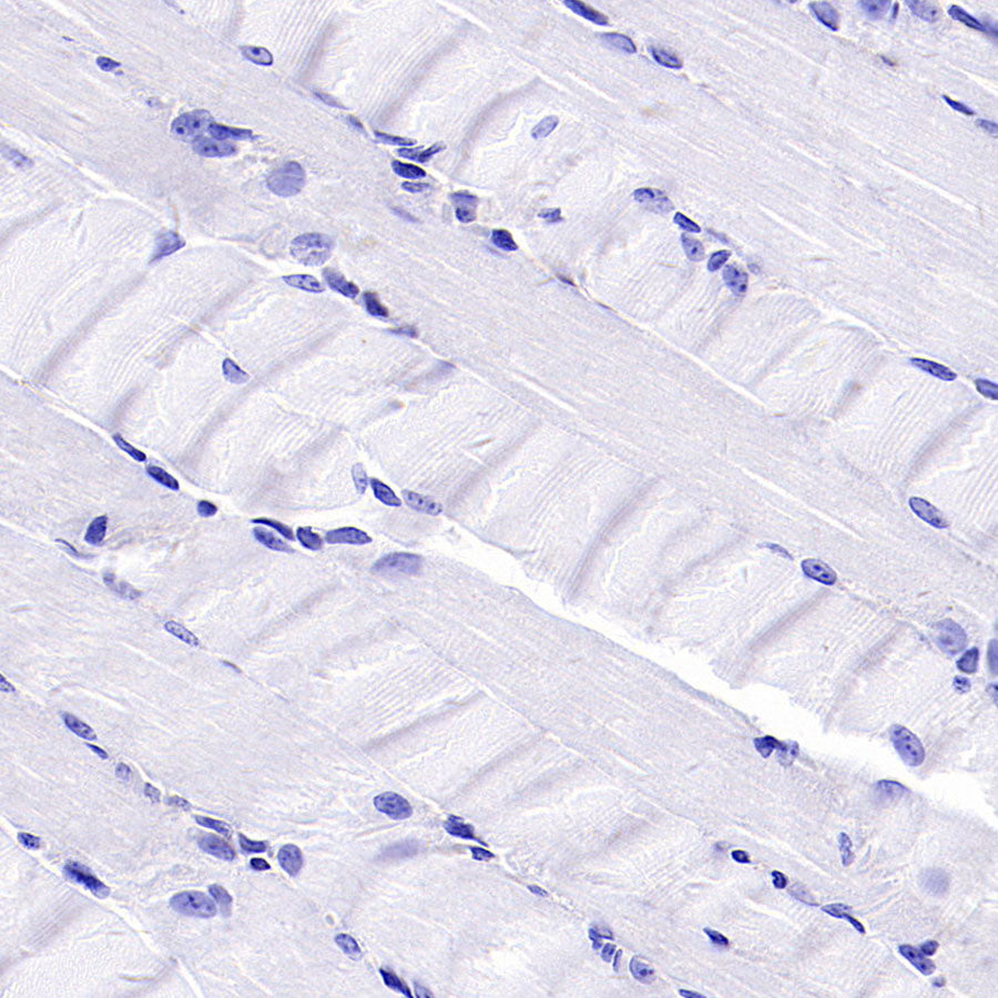 PTK7 Recombinant Rabbit mAb (SDT-2432-136)
