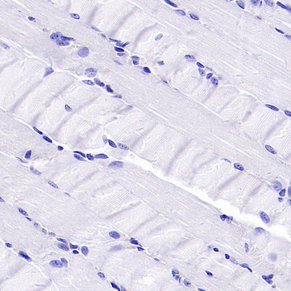PTK7 Recombinant Rabbit mAb (SDT-2432-136)