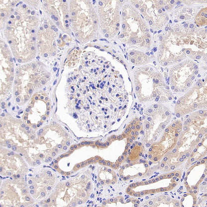 GAB1 Recombinant Rabbit mAb (S-3907-33)