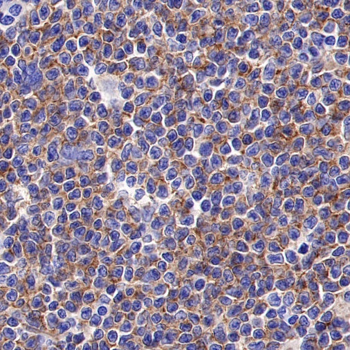 ROR1 Recombinant Rabbit mAb (SDT-R502)