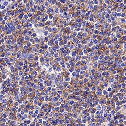 ROR1 Recombinant Rabbit mAb (SDT-R502)