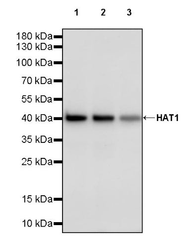 HAT1 Recombinant Rabbit mAb (S-2429-14)