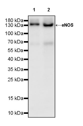 eNOS Recombinant Rabbit mAb (S-1885-94)