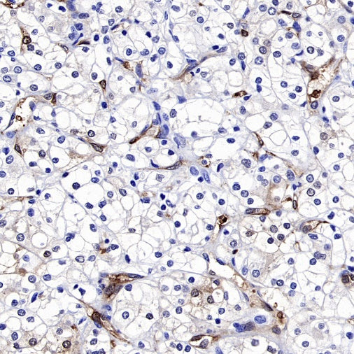 CA2 Rabbit Polyclonal Antibody