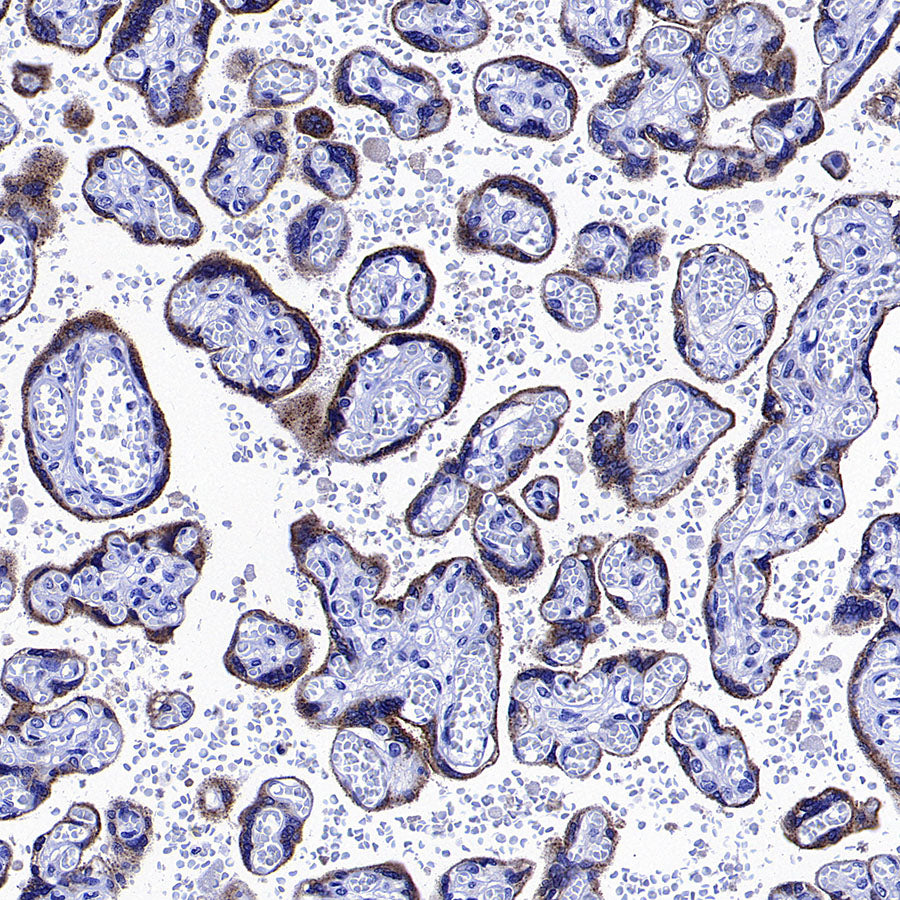 Glypican-3 Recombinant Rabbit mAb (SDT-4064-69-2)