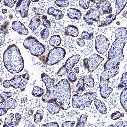 Glypican-3 Recombinant Rabbit mAb (SDT-4064-69-2)