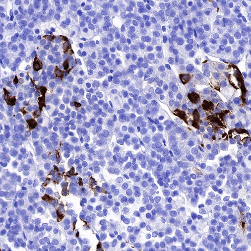 TSHB Recombinant Rabbit mAb (S-537-52)