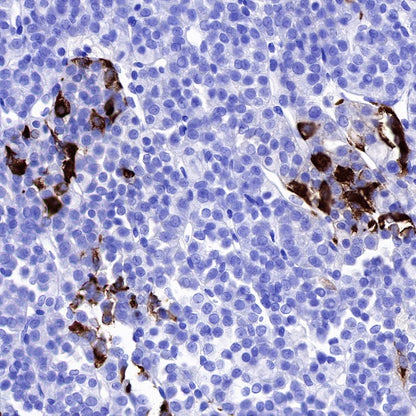 TSHB Recombinant Rabbit mAb (S-537-52)