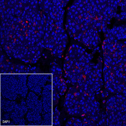 CD68 Recombinant Rabbit mAb (Alexa Fluor® 555 Conjugate) (S-R025)