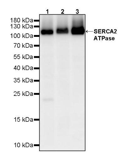 SERCA2 ATPase Recombinant Rabbit mAb (S-5956)