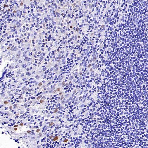 p21 Waf1/Cip1 Recombinant Rabbit mAb (SDT-1349-71)