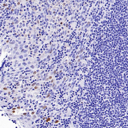 p21 Waf1/Cip1 Recombinant Rabbit mAb (SDT-1349-71)