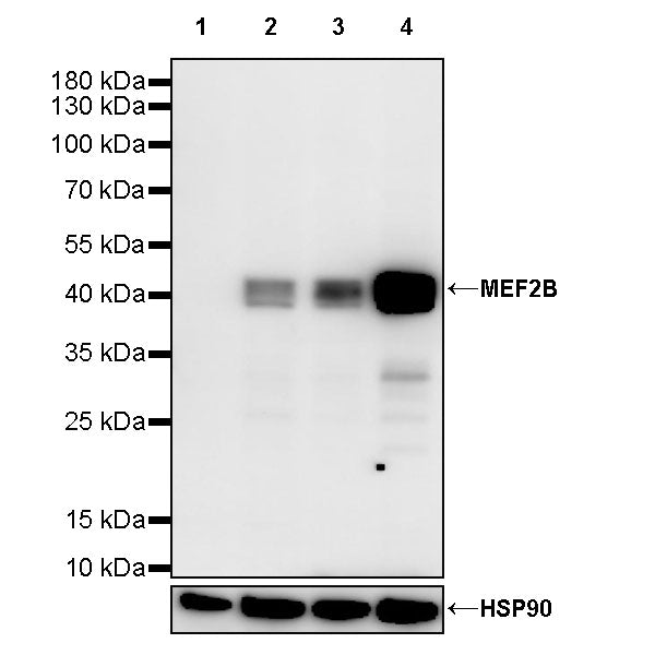 MEF2B Recombinant Rabbit mAb (S-3788-28)