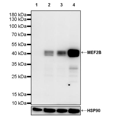 MEF2B Recombinant Rabbit mAb (S-3788-28)
