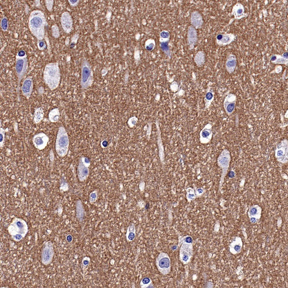 IDE Recombinant Rabbit mAb (S-1051-61)