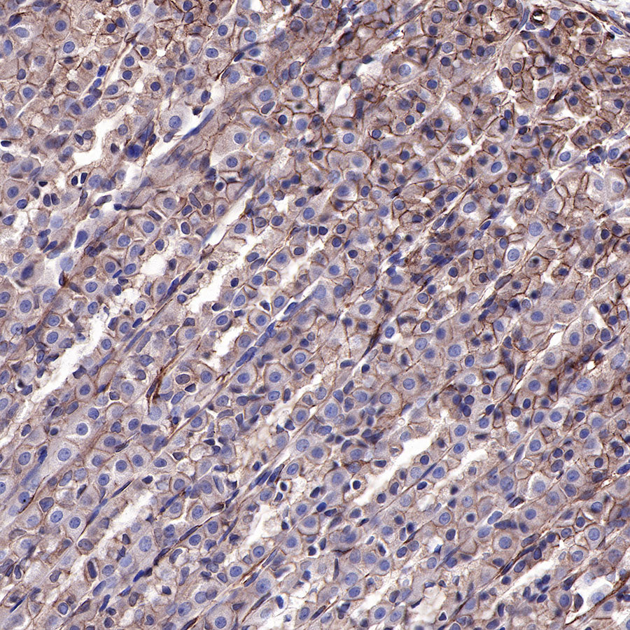 EGFR Recombinant Rabbit mAb (SDT-R110)