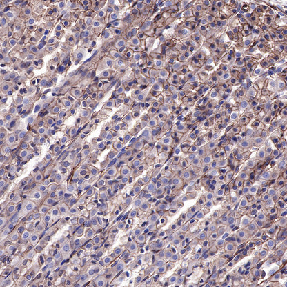 EGFR Recombinant Rabbit mAb (SDT-R110)