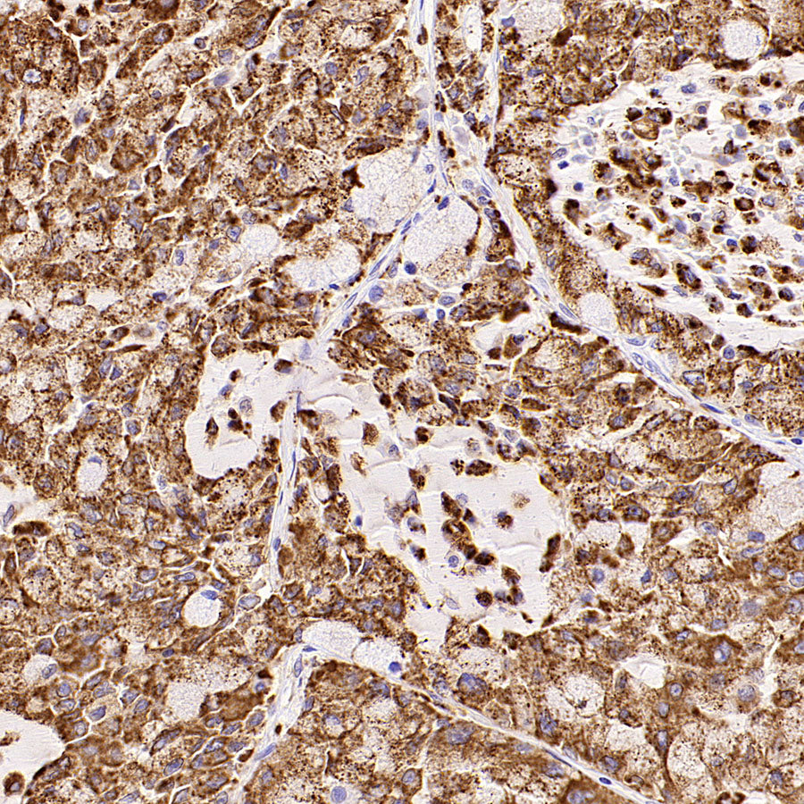 Napsin A Recombinant Mouse mAb (SDT-4204)