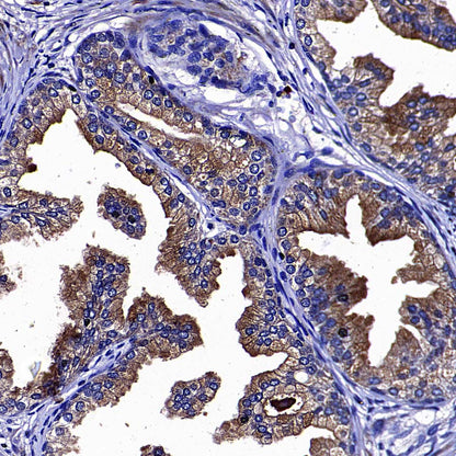 Rab27A Recombinant Rabbit mAb (S-4453-62)