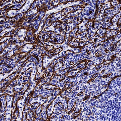 Vimentin Recombinant Rabbit mAb (SDT-029-120)