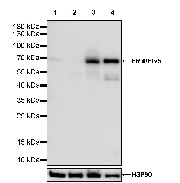 ERM / Etv5 Recombinant Rabbit mAb (S-3996-27)