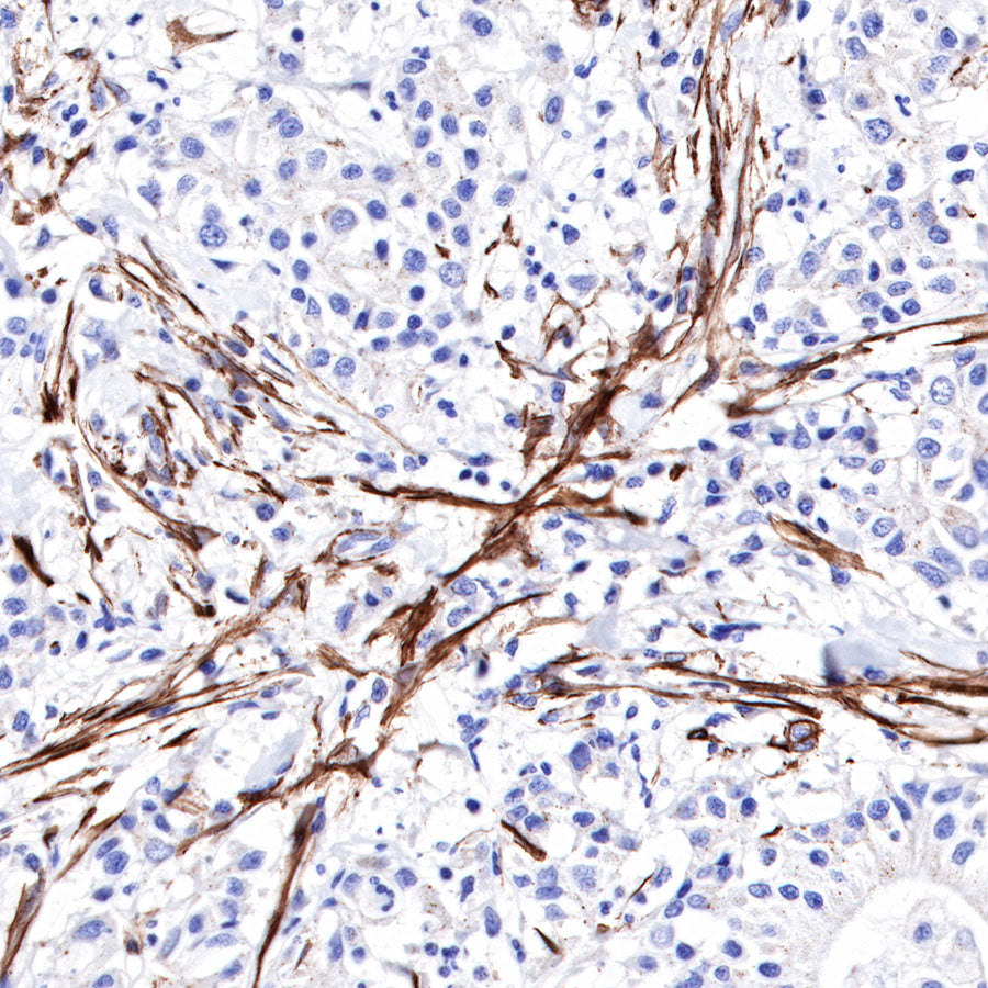 S-RMab® alpha smooth muscle Actin (SMA) Recombinant Rabbit mAb,PBS Only (SDT-301-142)
