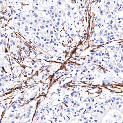 S-RMab® alpha smooth muscle Actin (SMA) Recombinant Rabbit mAb,PBS Only (SDT-301-142)