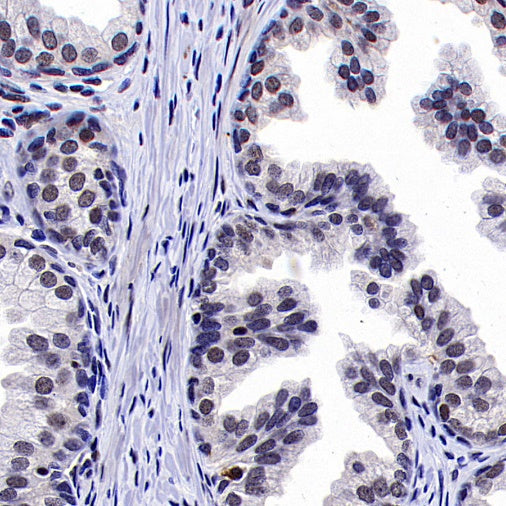 ERCC1 Recombinant Rabbit mAb,PBS Only (SDT-2458-29)