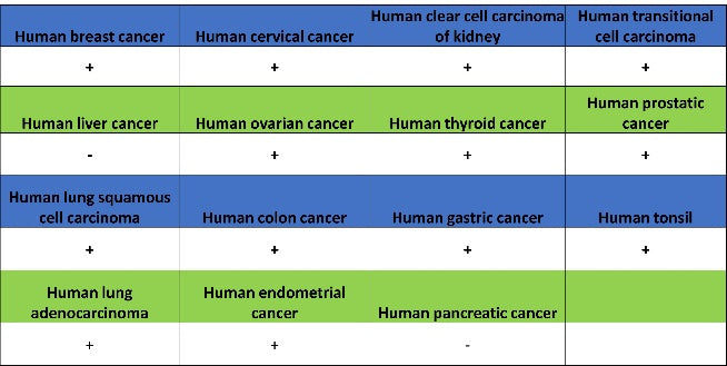 TAZ Recombinant Rabbit mAb (S-2812-102)