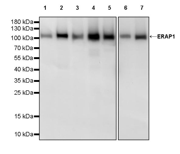 ERAP1 Recombinant Rabbit mAb (S-2509-38)