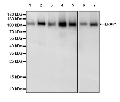 ERAP1 Recombinant Rabbit mAb (S-2509-38)