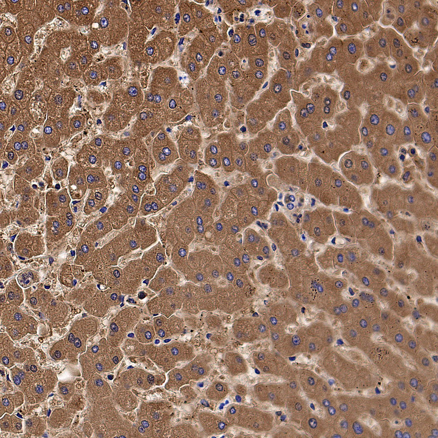 Aldh5a1 Recombinant Rabbit mAb (S-4135-76)