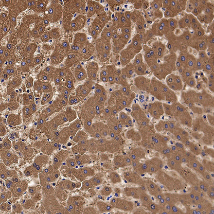 Aldh5a1 Recombinant Rabbit mAb (S-4135-76)