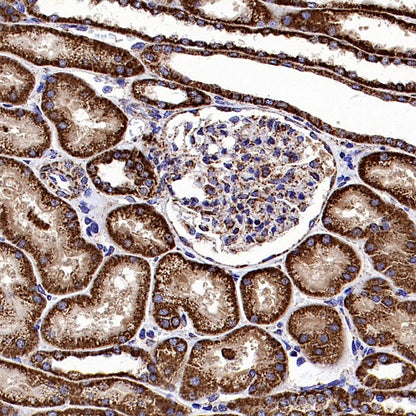 Fumarate hydratase Recombinant Rabbit mAb, PBS Only (SDT-2394-36)