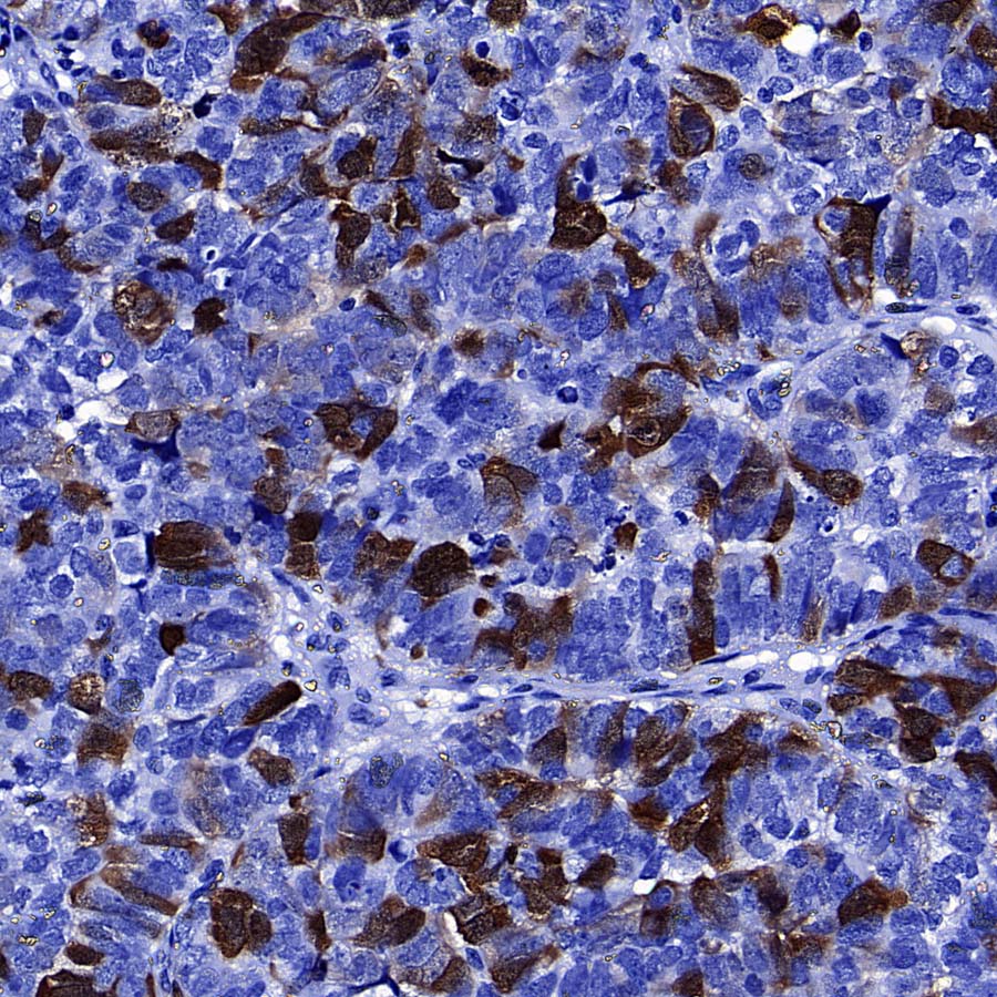 Thymidine Kinase 1 Recombinant Rabbit mAb (S-4127-43)