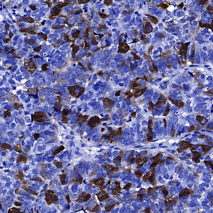Thymidine Kinase 1 Recombinant Rabbit mAb (S-4127-43)