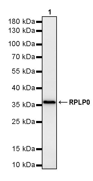 RPLP0 Rabbit Polyclonal Antibody