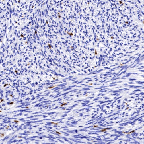 Factor XIIIa Recombinant Rabbit mAb (SDT-644-7)