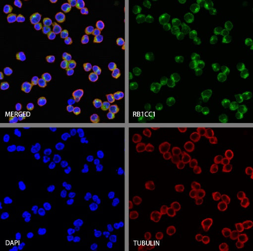 RB1CC1 Recombinant Rabbit mAb (S-2367-251)
