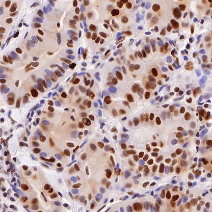 PCNA Recombinant Rabbit mAb (SDT-297-116)