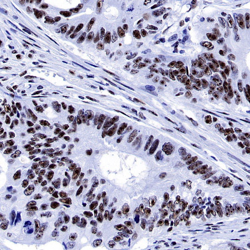 PELP1 Recombinant Rabbit mAb (S-756-22)