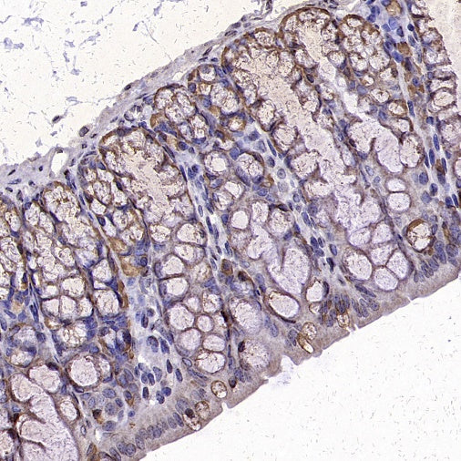 Anterior Gradient 2 Rabbit Polyclonal Antibody